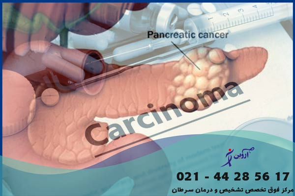 شیمی درمانی سرطان پانکراس